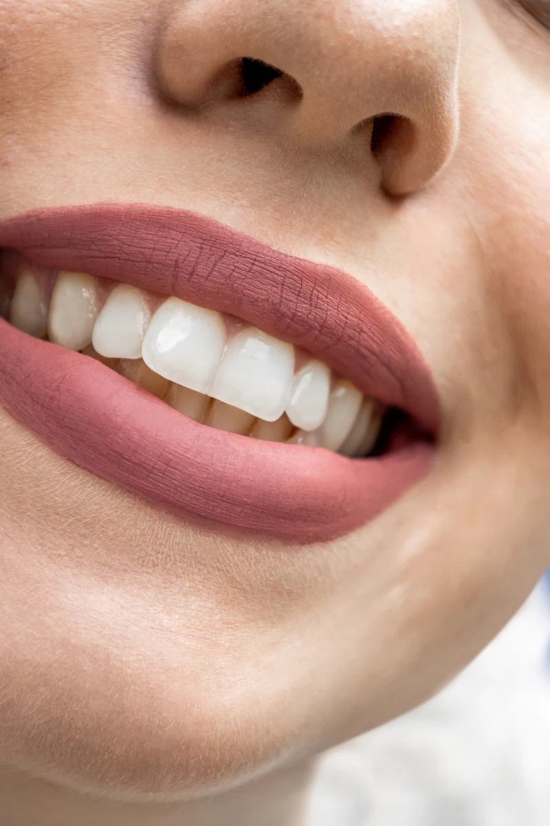 Close-up of a smile with clean, bright teeth