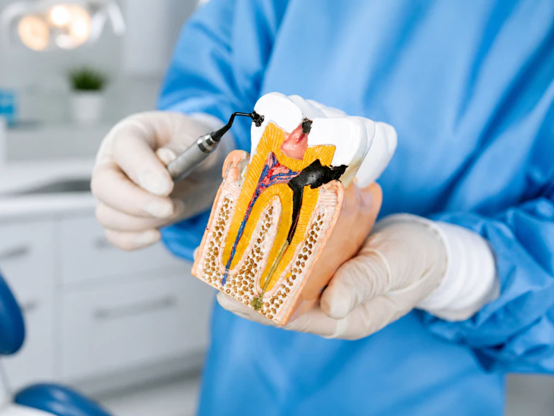 A gloved hand pointing at decay inside a cut-away model of a back tooth